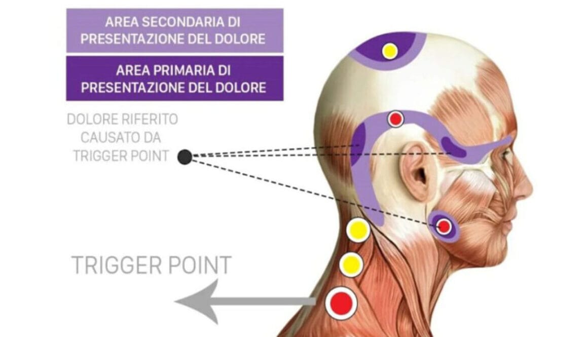 Una-problematica-molto-diffusa--la-Cervicalgia