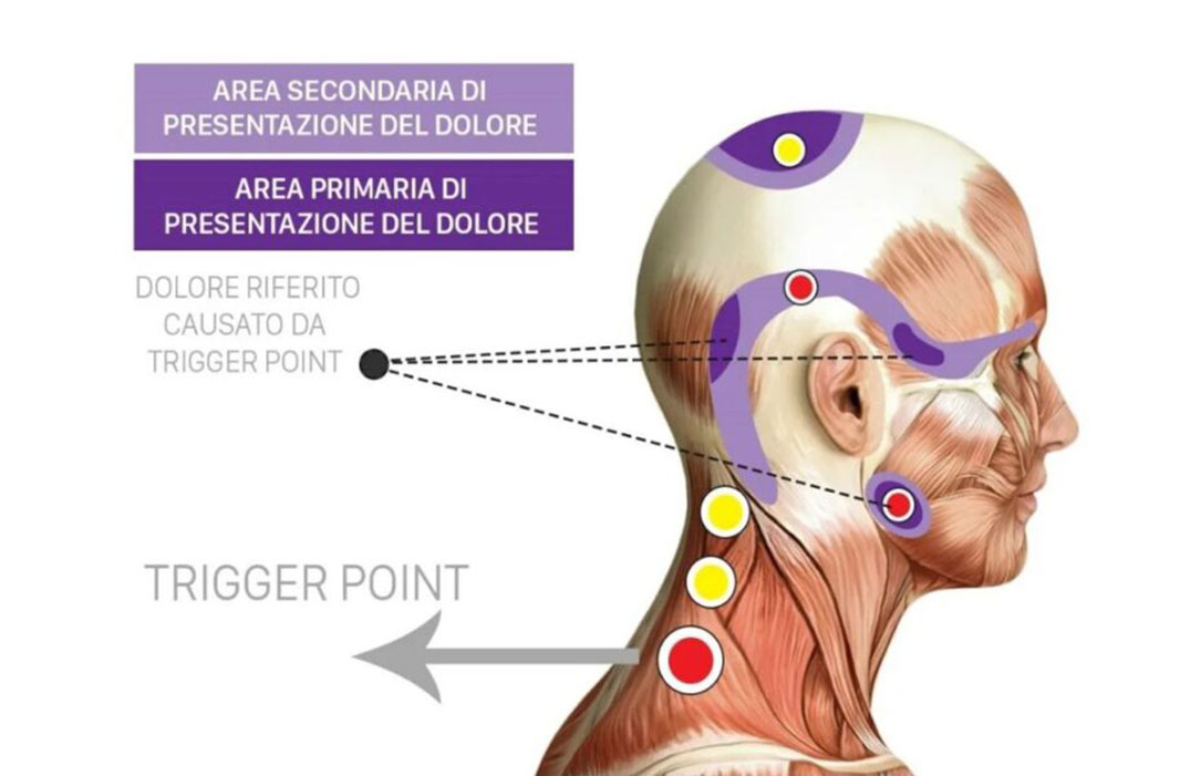 Una-problematica-molto-diffusa--la-Cervicalgia