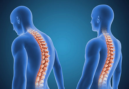 Osteopatia e Postura: un Approccio Scientifico Integrato